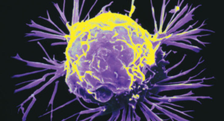Ученые выяснили, как раковые клетки обманывают имунную систему