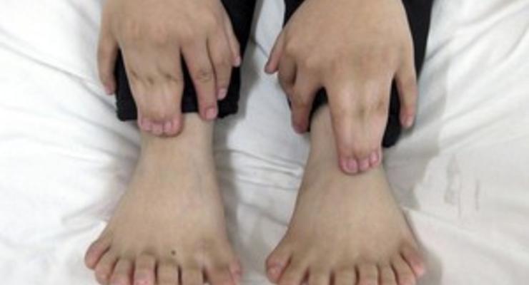 В Китае мальчику удалили 11 лишних пальцев