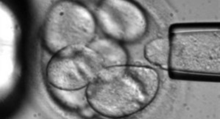 Ученые столкнулись с неожиданной проблемой при исследовании стволовых клеток