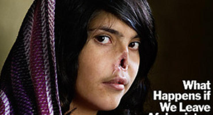 Снимок афганской девушки с отрезанным носом победил на World Press Photo