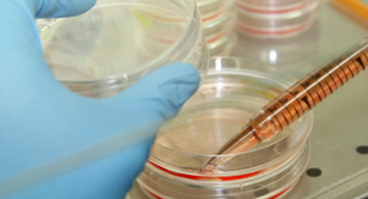 The Independent: Исследованиям в области стволовых клеток может быть положен конец
