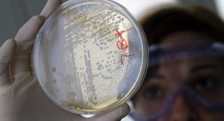 Ученые определили штамм бактерии E.coli