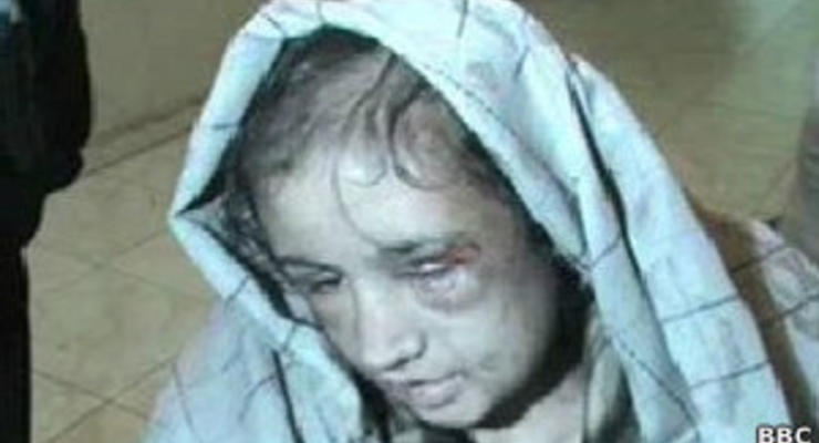 15-летнюю девочку в Афганистане пытала семья ее мужа