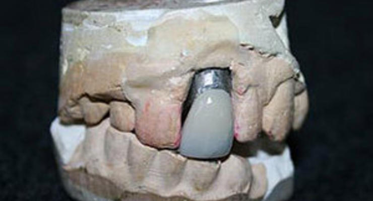 В Англии на аукцион выставят гипсовый слепок зубов Элвиса Пресли