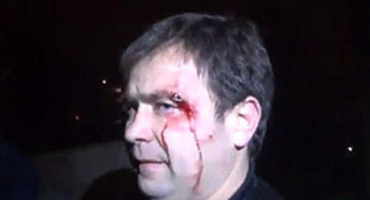 Дорожный контроль: В Киеве неизвестные, которых вызвали гаишники, до крови избили журналиста