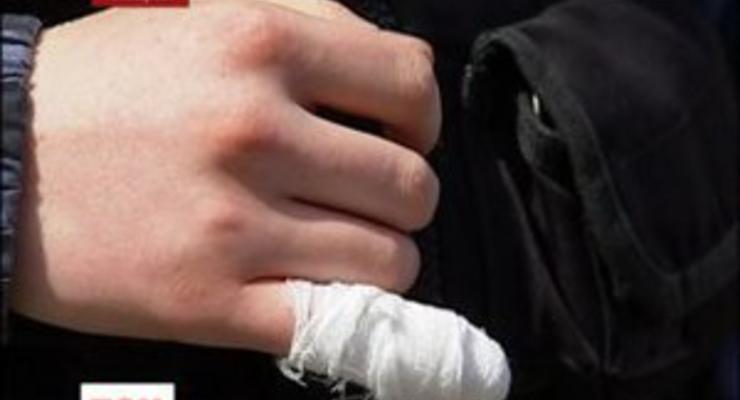 В Киевской области мужчина откусил кусок пальца инспектору ГАИ