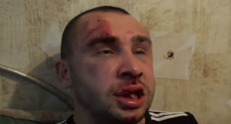 В Донецке избили журналиста Дорожного контроля