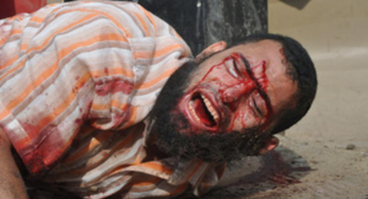 Фотогалерея: Самый кровавый день современной истории Египта. Репортаж из Каира