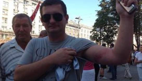 Оппозиция заявляет об избиении Беркутом народных избранников, один нардеп госпитализирован