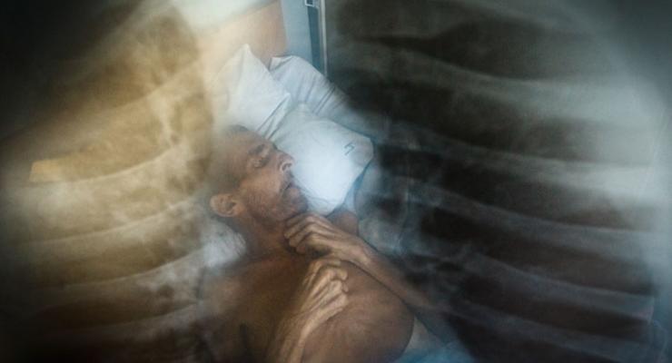 Нечеловеческие условия содержания больных туберкулезом в Украине (ФОТО)