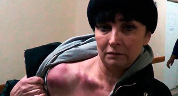 Неизвестные избили журналистку Дорожного контроля в лифте ее дома в Киеве