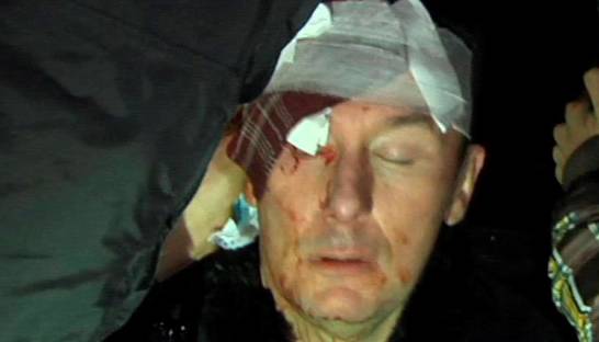 Луценко сегодня выпишут из больницы