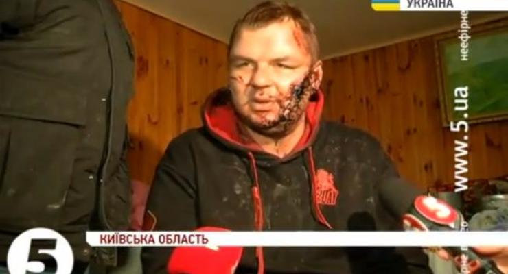 Активист Автомайдана Дмитрий Булатов, предположительно, находится в больнице