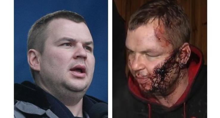 Покалеченный Булатов. Фото активиста Автомайдана до и после похищения