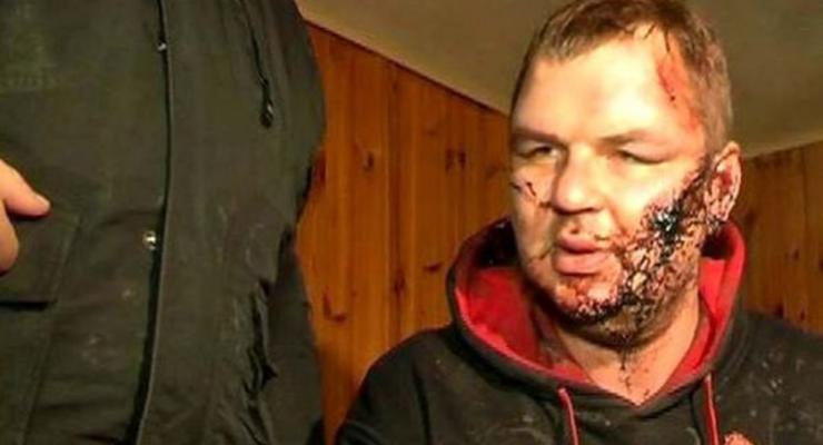 Главные ВИДЕО дня: Интервью избитого в плену активиста и "патроны Януковичу"