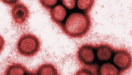 В Румынии два человека умерли от свиного гриппа