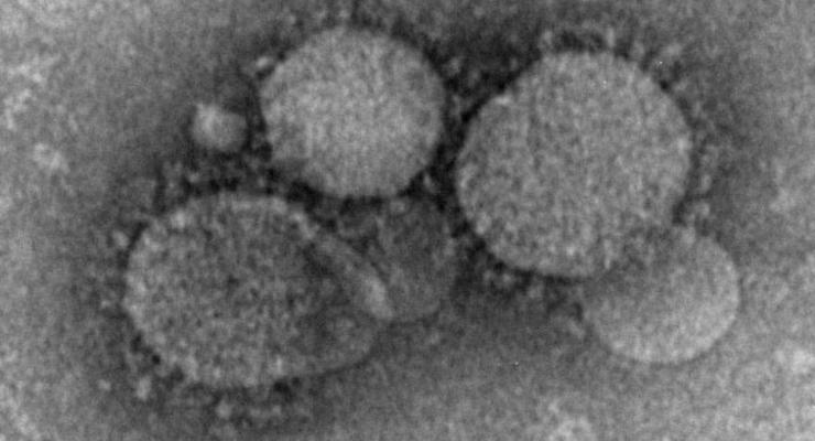 В Греции выявлен случай заражения опасным коронавирусом MERS