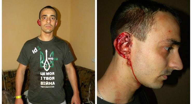 Основателя украинской соцсети побили за футболку с трезубцем