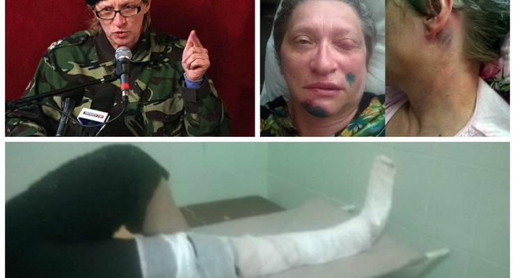 В России активистке ЛНР выбили глаз и переломали кости