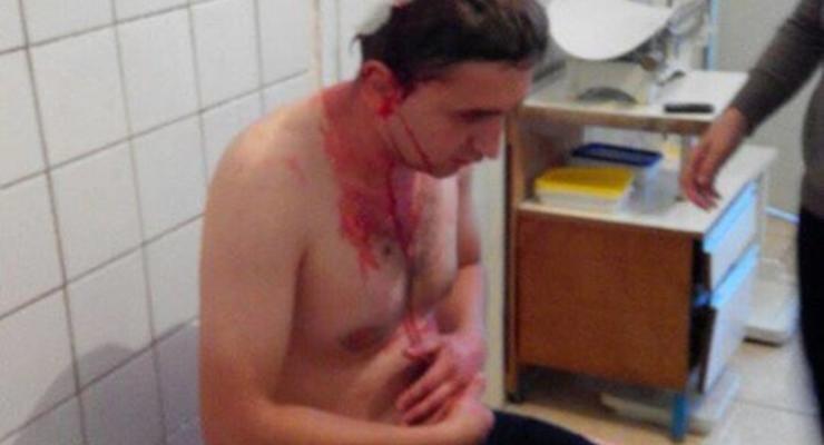Под Житомиром избили депутата Николайчука - журналист
