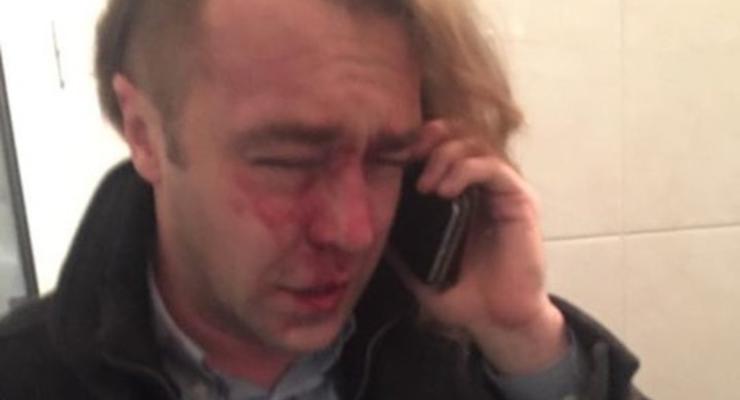 Свободовец Мирошниченко: Меня избил любовник бывшей жены