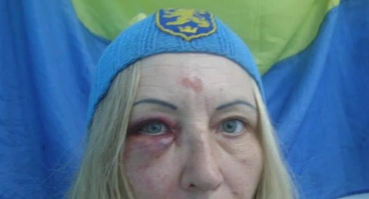 В Котовске военный избил волонтера