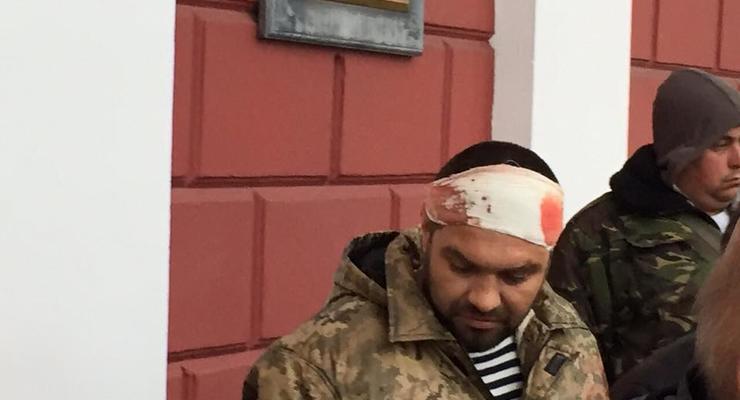 В Одессе 40 человек с битами напали на протестующих под мэрией