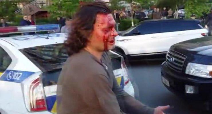 В сети появилось полное видео конфликта полиции и водителя Infiniti в Киеве