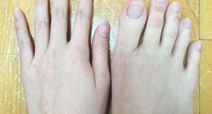 Что за пальцы? Фото женской ноги смутило пользователей Сети