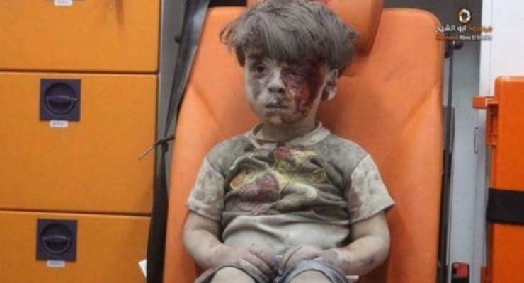 Сеть взволновало видео с мальчиком, выжившим после авиаудара в Сирии