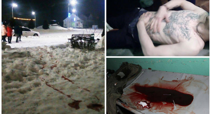 Массовая перестрелка в Олевске: один погибший и 6 раненых