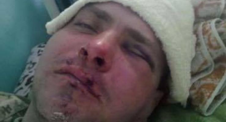 В Измаиле избили ветерана АТО из Правого сектора