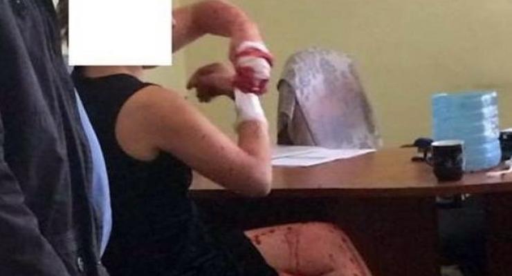 В Киеве задержали россиянку, сбежавшую из психбольницы Львова