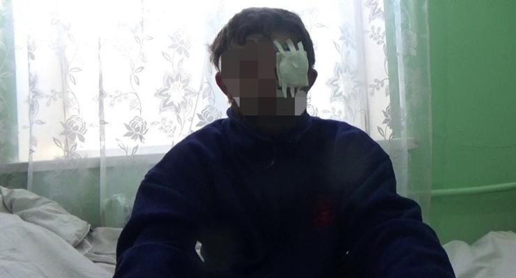 Регулярно приезжали инструктора из России: задержанный под Авдеевкой боевик дал показания
