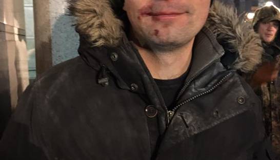 Беспорядки в центре Киева: пострадавший депутат рассказал подробности