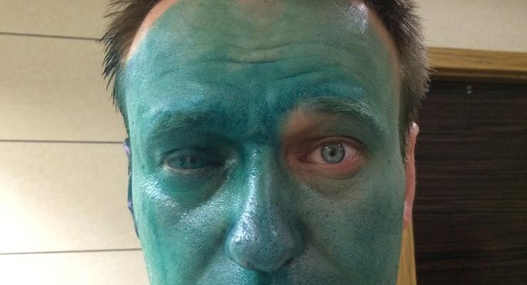 Навального облили зеленкой, пришлось вызвать скорую