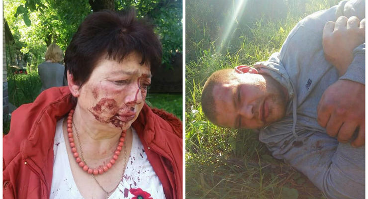 Под Киевом жестоко избили главу территориального избиркома
