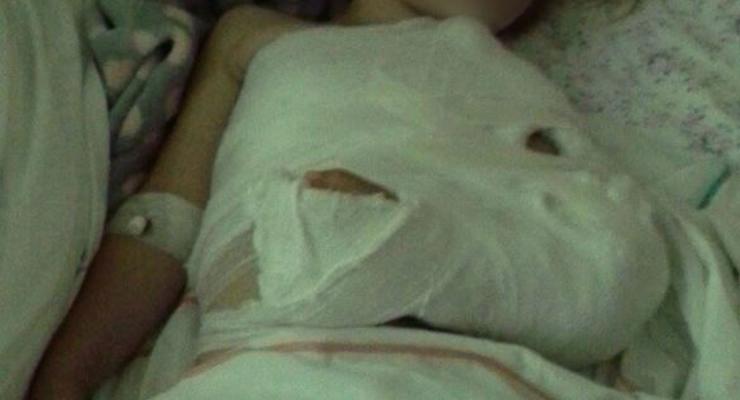 Трехлетняя девочка сломала руку на празднике в Dream Town