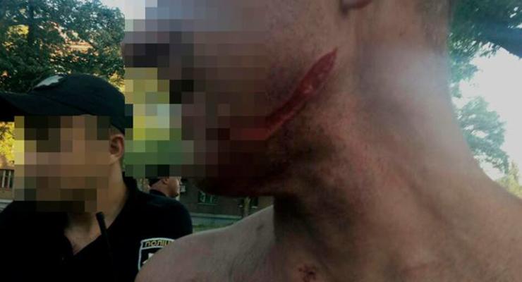В Запорожье мужчине порезали лицо из-за Дня ВДВ