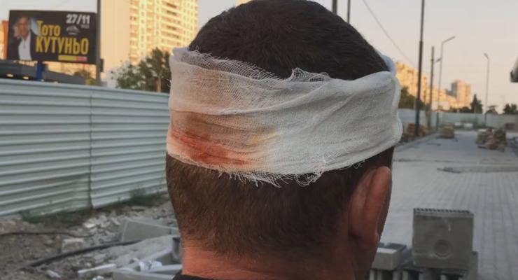 Титушки на Ревуцкого разбили голову охраннику - активист