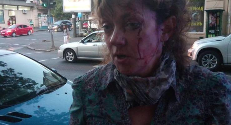 В Одессе избили известную активистку