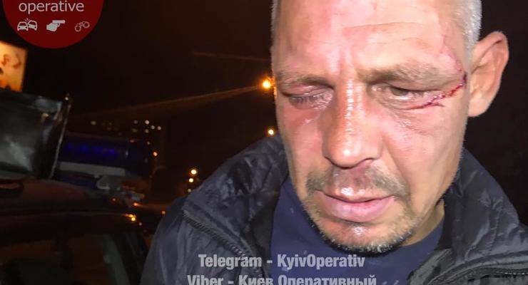 В Киеве мужчина украл у женщины сумку, ударив ее металлическим ключем