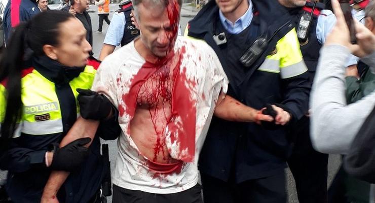 Референдум в Каталонии: стрельба и стычки с полицией