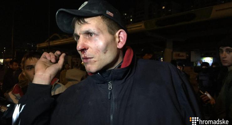 Столкновения у АЗС в Киеве: пострадали 14 человек