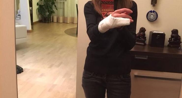 В Киеве полицейских обвинили в том, что они сломали руку женщине