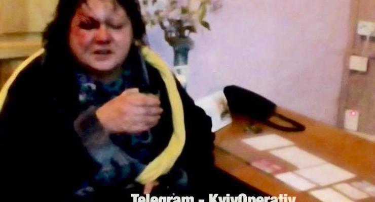 В Киеве мужчина в сауне изнасиловал и избил знакомую
