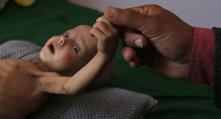 130 детей умирают каждый день в Йемене - Save the Children