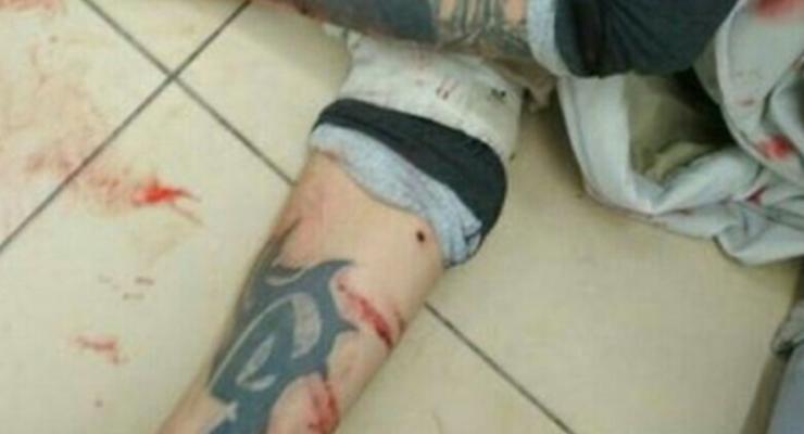 Житель Харькова пытался порезать себе вены в супермаркете