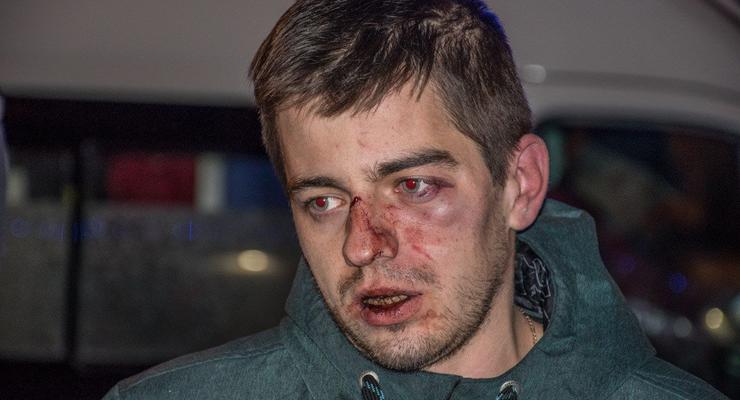 В центре Киева сотрудники пиццерии избили своих посетителей