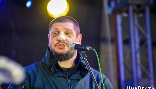 Николаевский губернатор показался с разбитым лицом